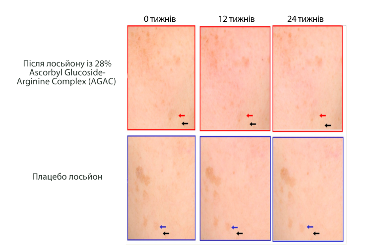 Освітлювальна дія ацетил глюкозиду